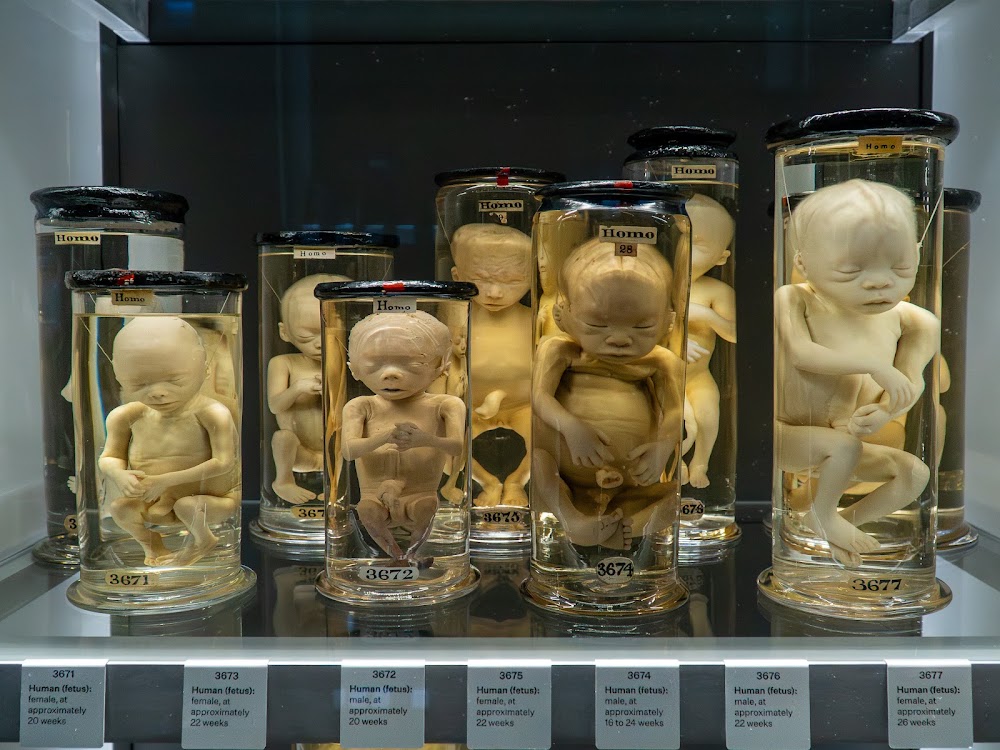 The Hunterian Museum photo 2